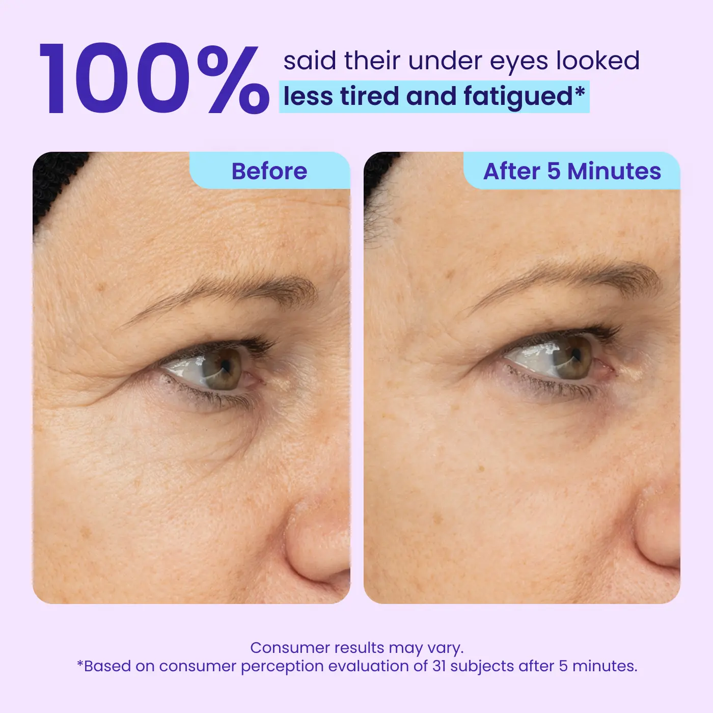Erase Eye Bags in Minutes —Eye Cream Look Refreshed Instantly ⚡Flash Sale🔥(The second item is 60% off!)