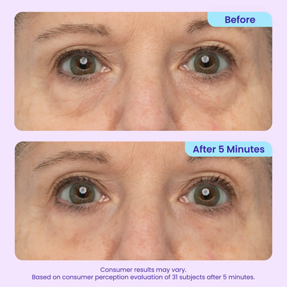 Erase Eye Bags in Minutes —Eye Cream Look Refreshed Instantly ⚡Flash Sale🔥(The second item is 60% off!)