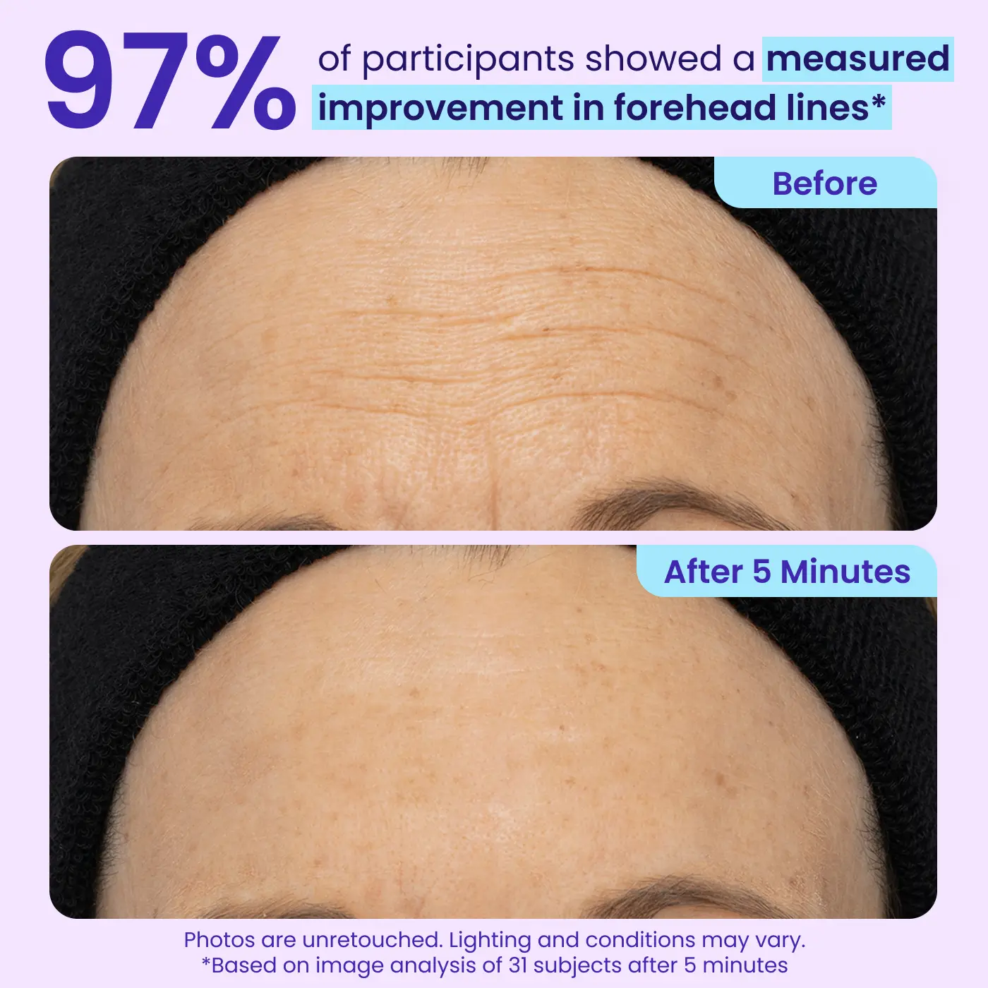 Erase Eye Bags in Minutes —Eye Cream Look Refreshed Instantly ⚡Flash Sale🔥(The second item is 60% off!)