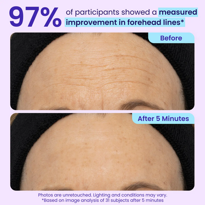 Erase Eye Bags in Minutes —Eye Cream Look Refreshed Instantly ⚡Flash Sale🔥(The second item is 60% off!)
