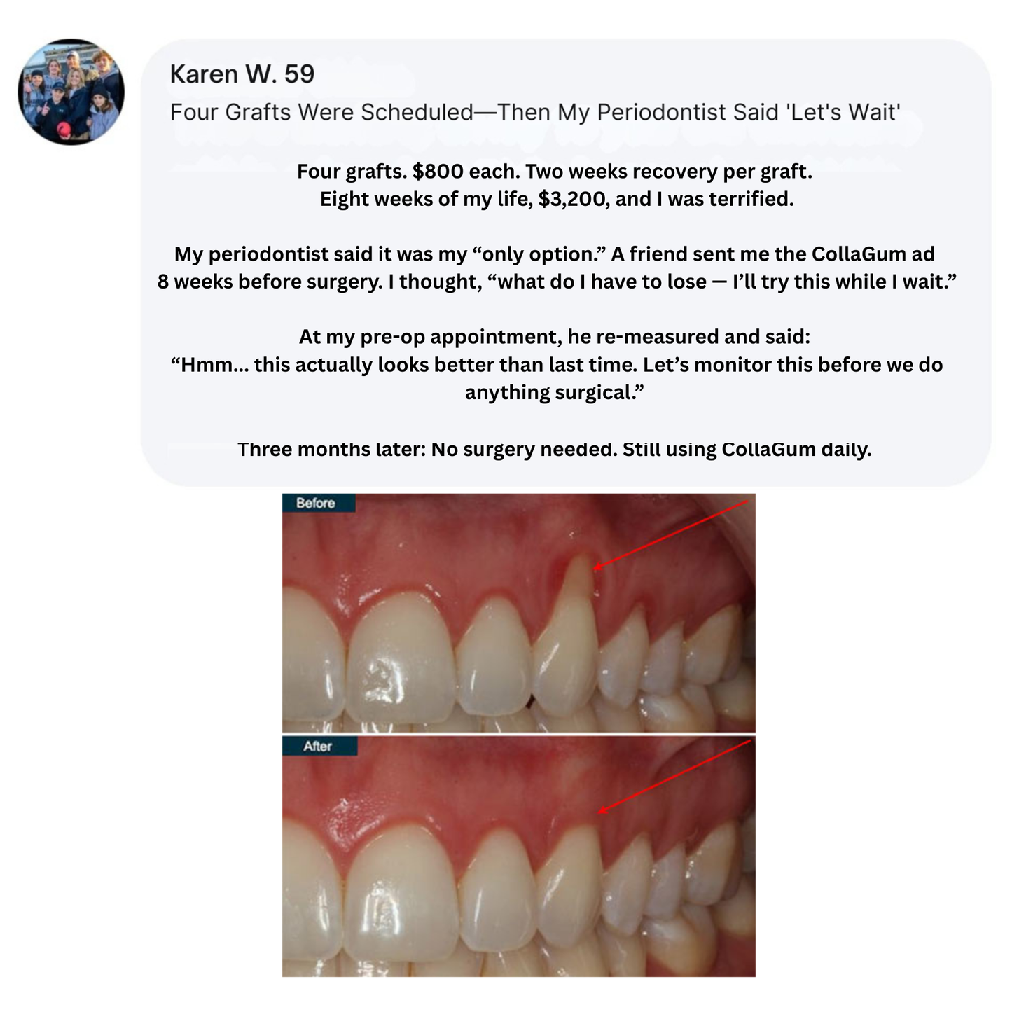 Collagun Tooth Powder
