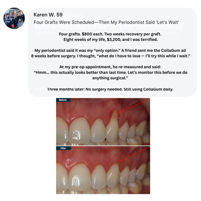 Collagun Tooth Powder