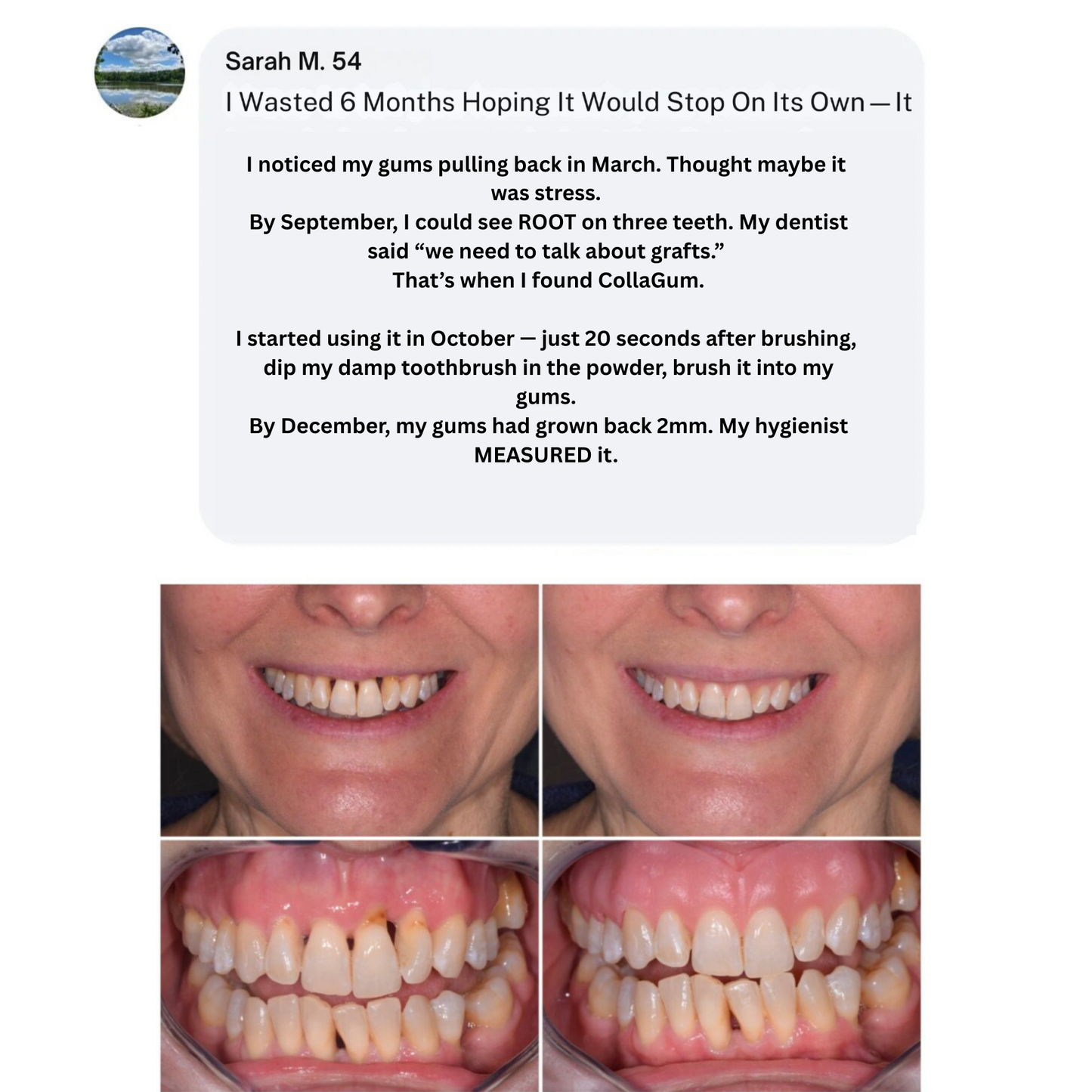 Collagun Tooth Powder