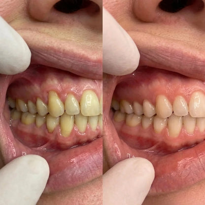 Collagun Tooth Powder