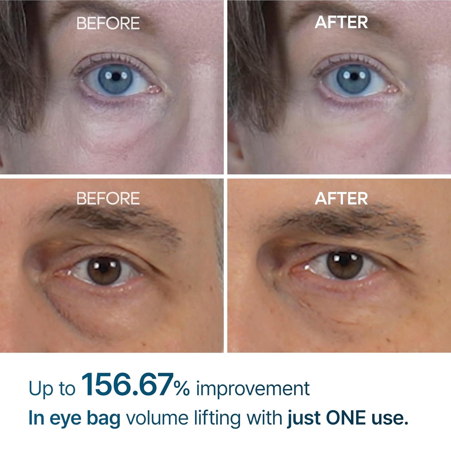 Pryxo™ Eyephalt Eyebag Cream(The second item is 60% off!)