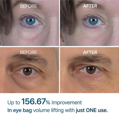 Pryxo™ Eyephalt Eyebag Cream(The second item is 60% off!)