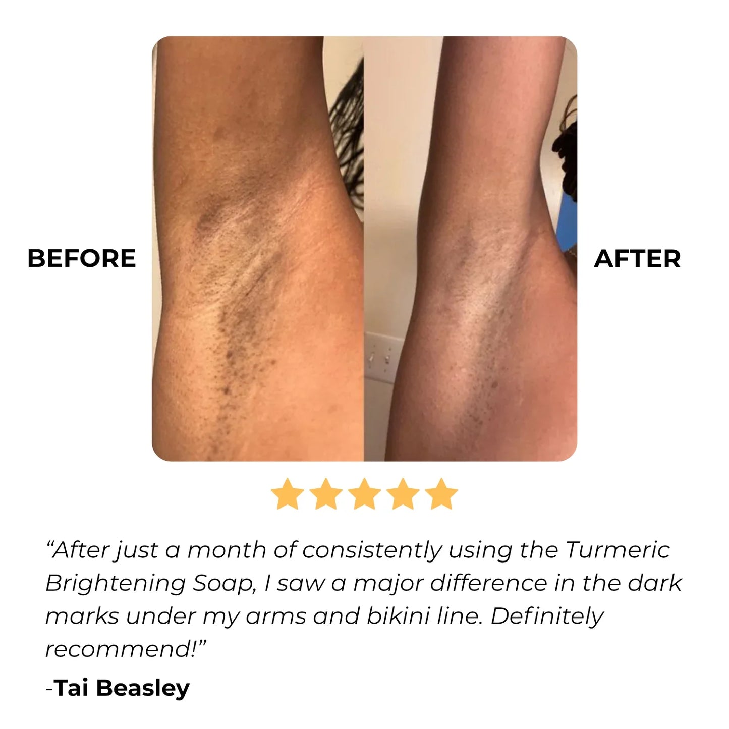 lemon turmeric & kojic acid brightening soap（The second one is 40% off!）